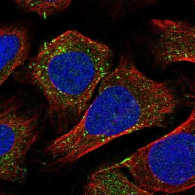 Immunocytochemistry/ Immunofluorescence: Rabenosyn 5 Antibody [NBP1-92310]