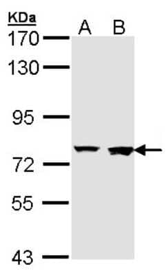 Western Blot: Rabenosyn 5 Antibody [NBP1-33649]