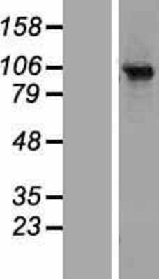 Western Blot: Rabenosyn 5 Overexpression Lysate [NBP2-06448]