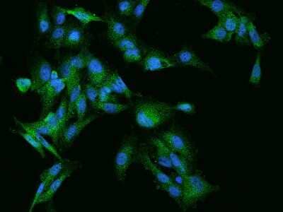 Immunocytochemistry/ Immunofluorescence: Rabex5 Antibody [NBP2-97267]