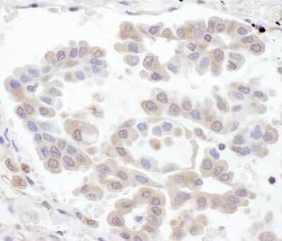 Immunohistochemistry-Paraffin: Rabex5 Antibody [NBP1-49938]