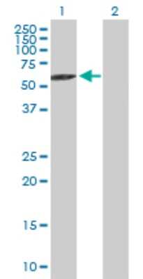 Western Blot: Rabex5 Antibody [H00027342-B01P]
