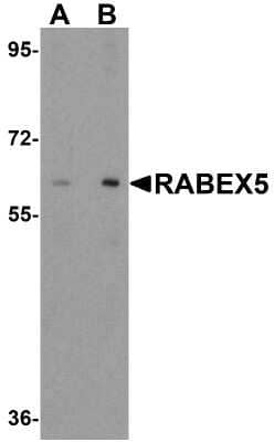 Western Blot: Rabex5 AntibodyBSA Free [NBP1-76548]