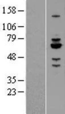 Western Blot: Rabex5 Overexpression Lysate [NBL1-15095]