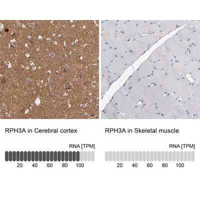 Immunohistochemistry-Paraffin: Rabphilin 3A Antibody [NBP1-87940]