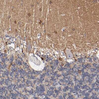 Immunohistochemistry-Paraffin: Rabphilin 3A Antibody [NBP1-87940]
