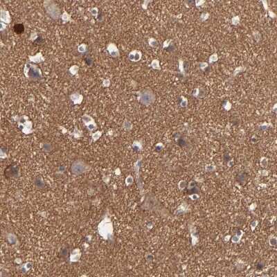 Immunohistochemistry-Paraffin: Rabphilin 3A Antibody [NBP1-87940]