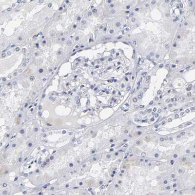 Immunohistochemistry-Paraffin: Rabphilin 3A Antibody [NBP1-87940]