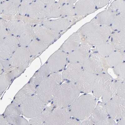 Immunohistochemistry-Paraffin: Rabphilin 3A Antibody [NBP1-87940]