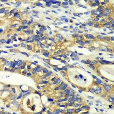 Immunohistochemistry-Paraffin: Rabphilin 3A Antibody - BSA Free [NBP2-95144]