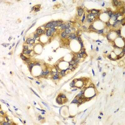 Immunohistochemistry-Paraffin: Rabphilin 3A Antibody - BSA Free [NBP2-95144]
