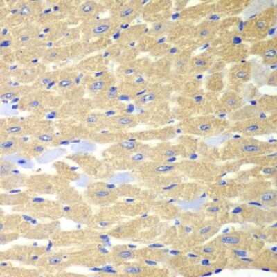 Immunohistochemistry-Paraffin: Rabphilin 3A Antibody - BSA Free [NBP2-95144]