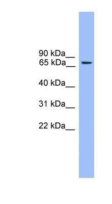 Western Blot: Rabphilin 3A Antibody [NBP1-69184]