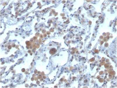 Immunohistochemistry-Paraffin: Rac1 Antibody (CPTC-RAC1-1) [NBP3-07195]