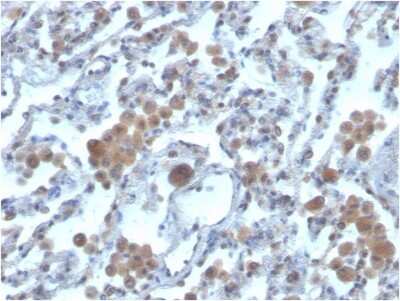 Immunohistochemistry-Paraffin: Rac1 Antibody (CPTC-RAC1-1) - Azide and BSA Free [NBP3-08939]