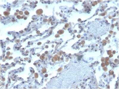 Immunohistochemistry-Paraffin: Rac1 Antibody (CPTC-RAC1-1) - Azide and BSA Free [NBP3-08939]
