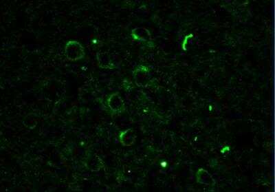 Immunocytochemistry/ Immunofluorescence: Rac1 Antibody [NB100-91266]