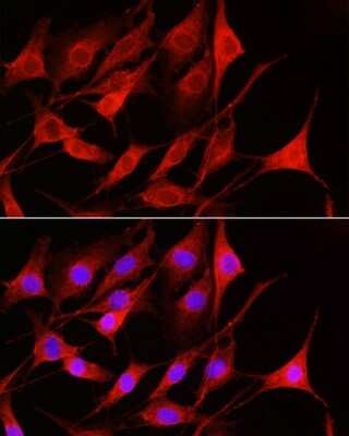 Immunocytochemistry/ Immunofluorescence: Rac1 Antibody - Azide and BSA Free [NBP2-94917]
