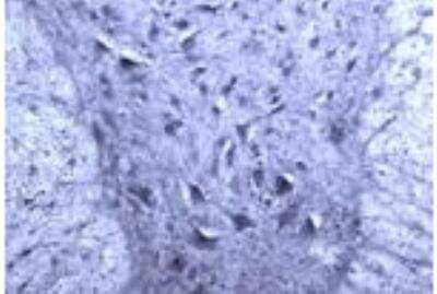 Immunohistochemistry: Rac1 Antibody [NB100-91266]