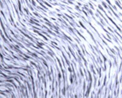 Immunohistochemistry: Rac1 Antibody [NB100-91266]