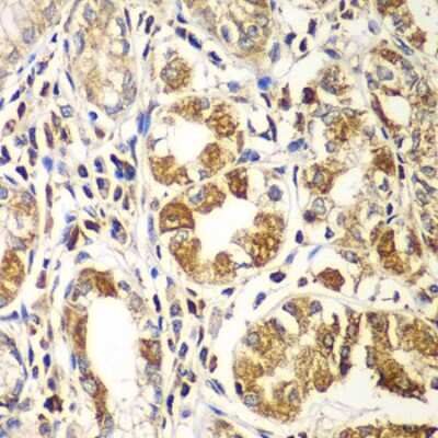 Immunohistochemistry-Paraffin: Rac1 Antibody - Azide and BSA Free [NBP2-94917]