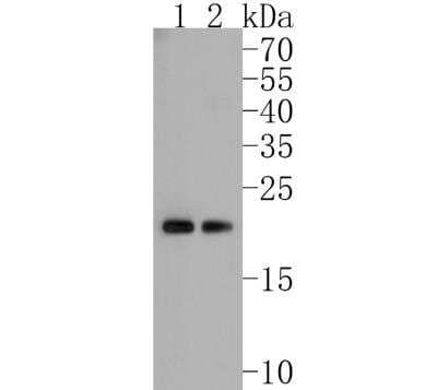 Western Blot: Rac1 Antibody (JM11-29) [NBP2-67091]