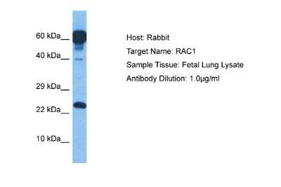 Western Blot: Rac1 Antibody [NBP2-82328]