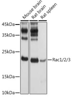 Western Blot: Rac1 AntibodyAzide and BSA Free [NBP2-94917]