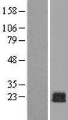 Western Blot: Rac1 Overexpression Lysate [NBL1-15105]