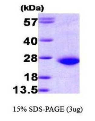 SDS-PAGE: Recombinant Human Rac1 His Protein [NBP1-30261]