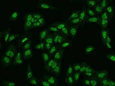 Immunocytochemistry/ Immunofluorescence: Rad1 Antibody [NBP2-97717]