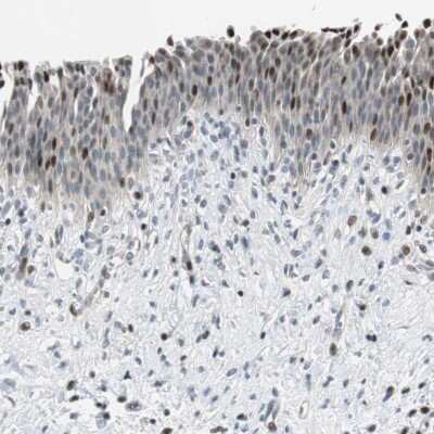 Immunohistochemistry-Paraffin: Rad1 Antibody [NBP2-13196]