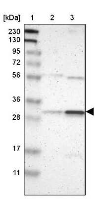 Western Blot: Rad1 Antibody [NBP2-13196]