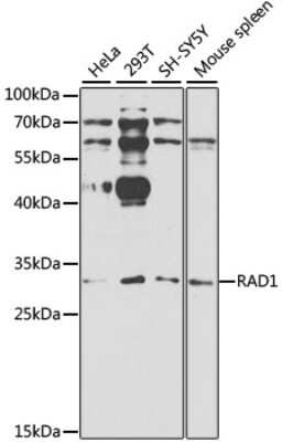 Western Blot: Rad1 AntibodyBSA Free [NBP2-93566]