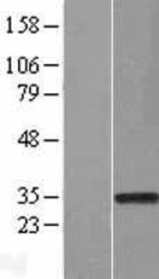 Western Blot: Rad1 Overexpression Lysate [NBL1-15110]