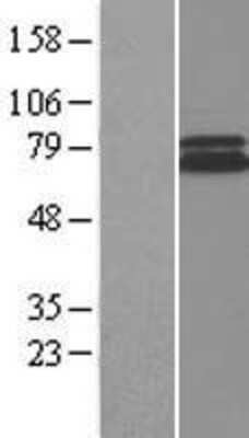 Western Blot: Rad1 Overexpression Lysate [NBP2-04415]