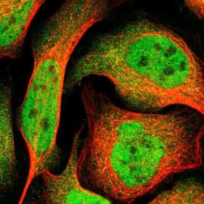 Immunocytochemistry/ Immunofluorescence: Rad17 Antibody [NBP1-86561]