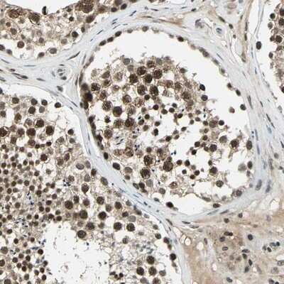 Immunohistochemistry-Paraffin: Rad17 Antibody [NBP1-86561]