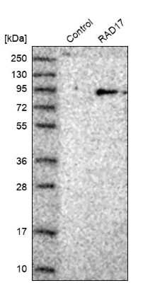 Western Blot: Rad17 Antibody [NBP1-86561]