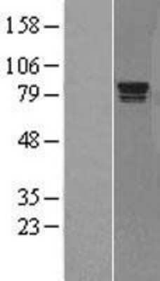 Western Blot: Rad17 Overexpression Lysate [NBL1-15111]