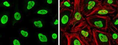 Immunocytochemistry/ Immunofluorescence: Rad21 Antibody [NBP2-20053]