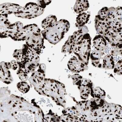Immunohistochemistry-Paraffin: Rad21 Antibody [NBP1-83260]