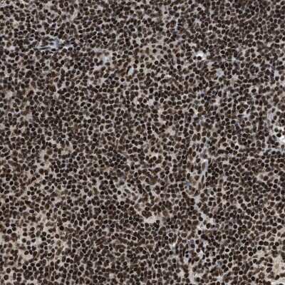 Immunohistochemistry-Paraffin: Rad21 Antibody [NBP1-83260]