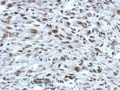 Immunohistochemistry-Paraffin: Rad21 Antibody [NBP2-20053]