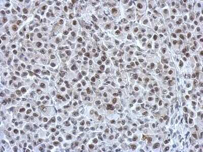Immunohistochemistry-Paraffin: Rad21 Antibody [NBP2-20053]