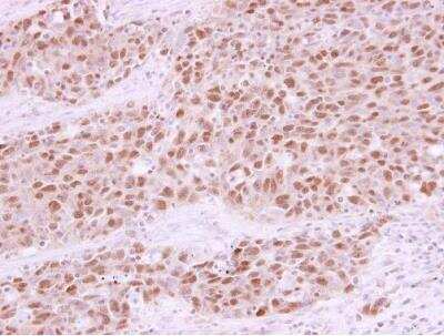 Immunohistochemistry-Paraffin: Rad21 Antibody [NBP2-20053]