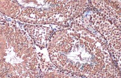 Immunohistochemistry-Paraffin: Rad21 Antibody [NBP2-20053]