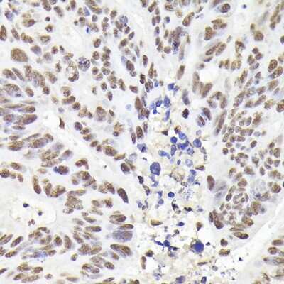 Immunohistochemistry-Paraffin: Rad21 Antibody - Azide and BSA Free [NBP3-15608]
