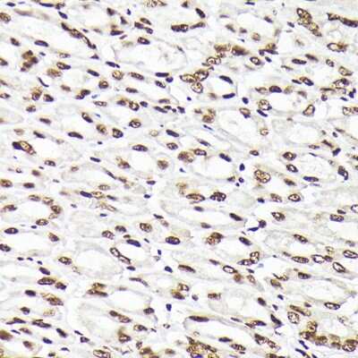 Immunohistochemistry-Paraffin: Rad21 Antibody - Azide and BSA Free [NBP3-15608]