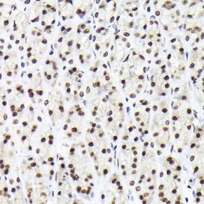 Immunohistochemistry-Paraffin: Rad21 Antibody - Azide and BSA Free [NBP3-15608]